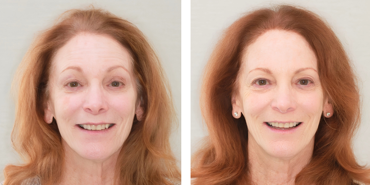 Before and After - Orthodontics