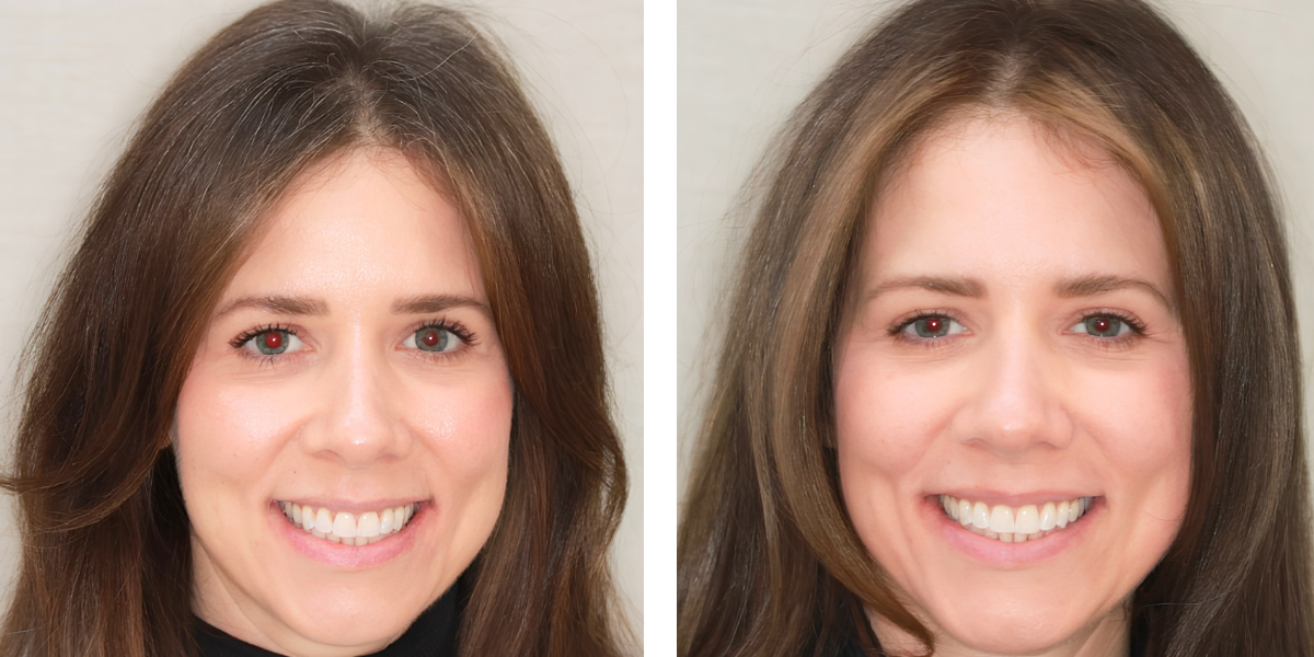 Before and After - Orthodontics