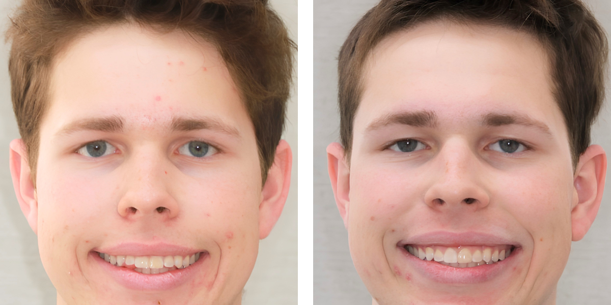 Before and After - Orthodontics